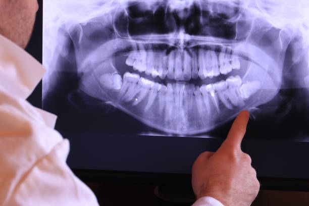 Best Emergency Dentist for Knocked-Out Tooth in Clyde, NC