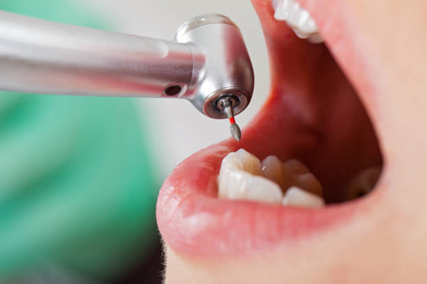 Best Broken or Cracked Tooth Emergency Dentist in Clyde, NC
